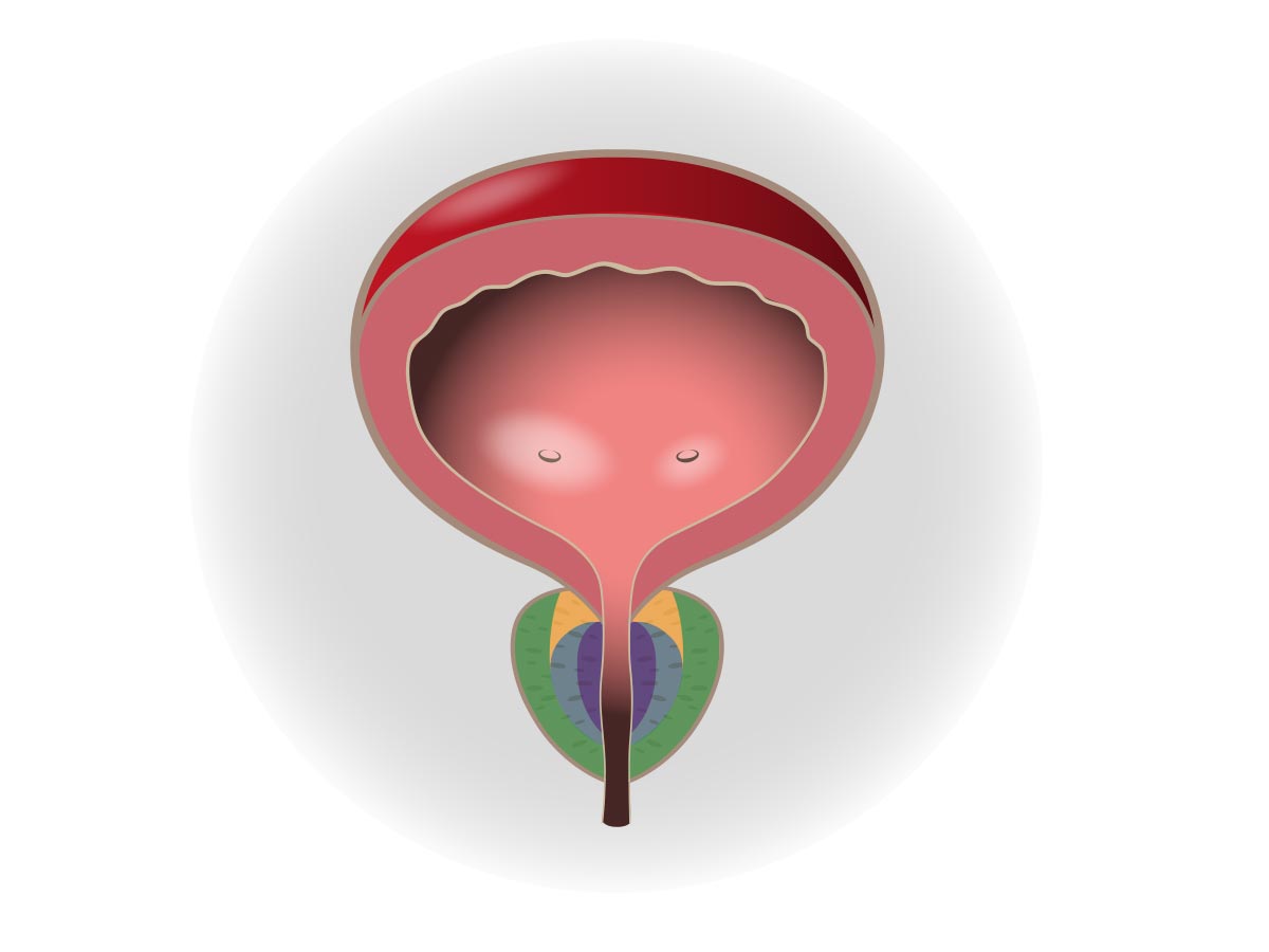 Prostatakrebs – Anatomie der Prostatazonen